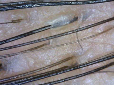 Videodermatoskop DIino-Lite MEDL7DW