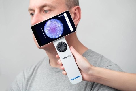 Medyczny system kamer diagnostycznych RCS-100 dermatoskop, otoskop + kamera